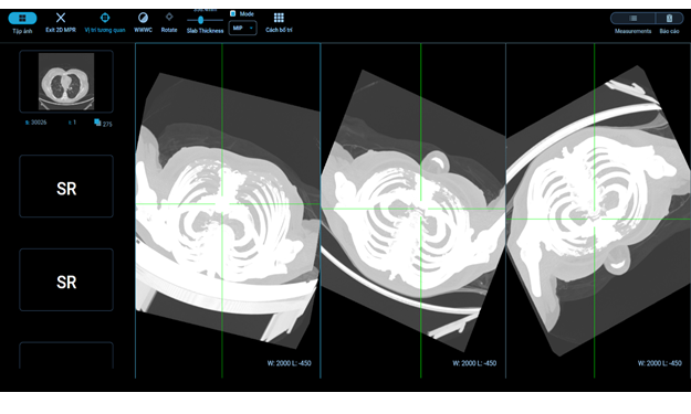 Công cụ chẩn đoán hình ảnh (MPR, 3D..)
